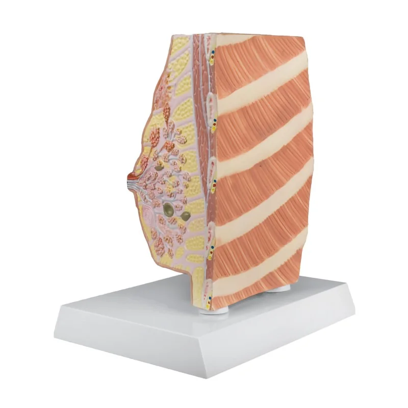 Modèle du sein avec maladies, taille réelle 2 Modèle du sein avec maladies, taille réelle 2