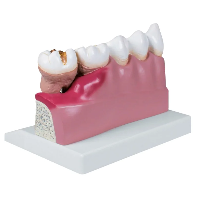 Modèle dentaire mâchoire inférieure, 4 fois la taille réelle Modèle dentaire mâchoire inférieure, 4 fois la taille réelle