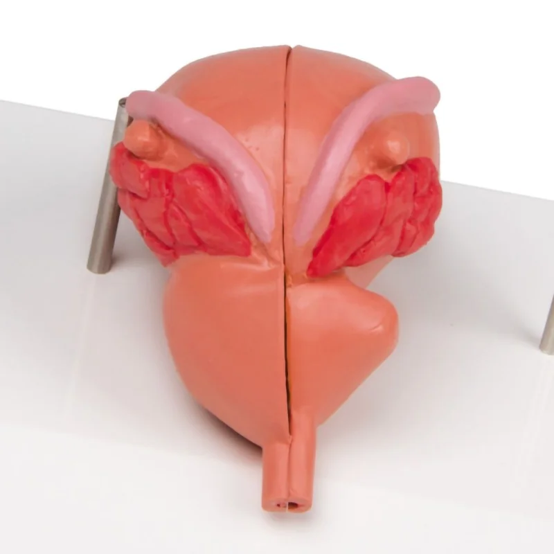 Modèle de prostate, 2 parties Modèle de prostate, 2 parties