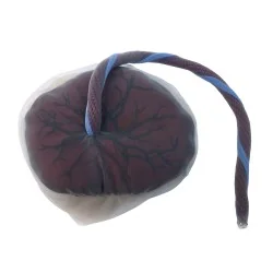 Modèle de placenta avec cordon ombilical