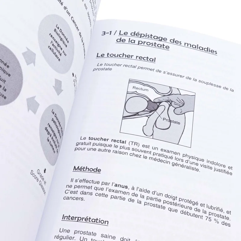 Cancer de la prostate : comprendre, anticiper, guérir Cancer de la prostate : comprendre, anticiper, guérir