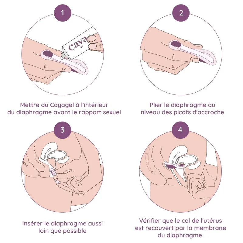 utilisation diaphragme Caya utilisation diaphragme Caya